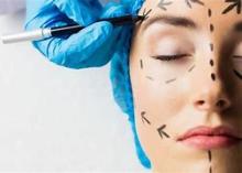 Chirurgie esthetique
